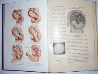 STAROŽITNÉ LEKÁRSKE KNIHY - 6