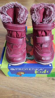 Dievcenske cizmicky protetika - 6