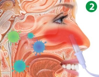 Stop chrápaniu a alergiám - 6