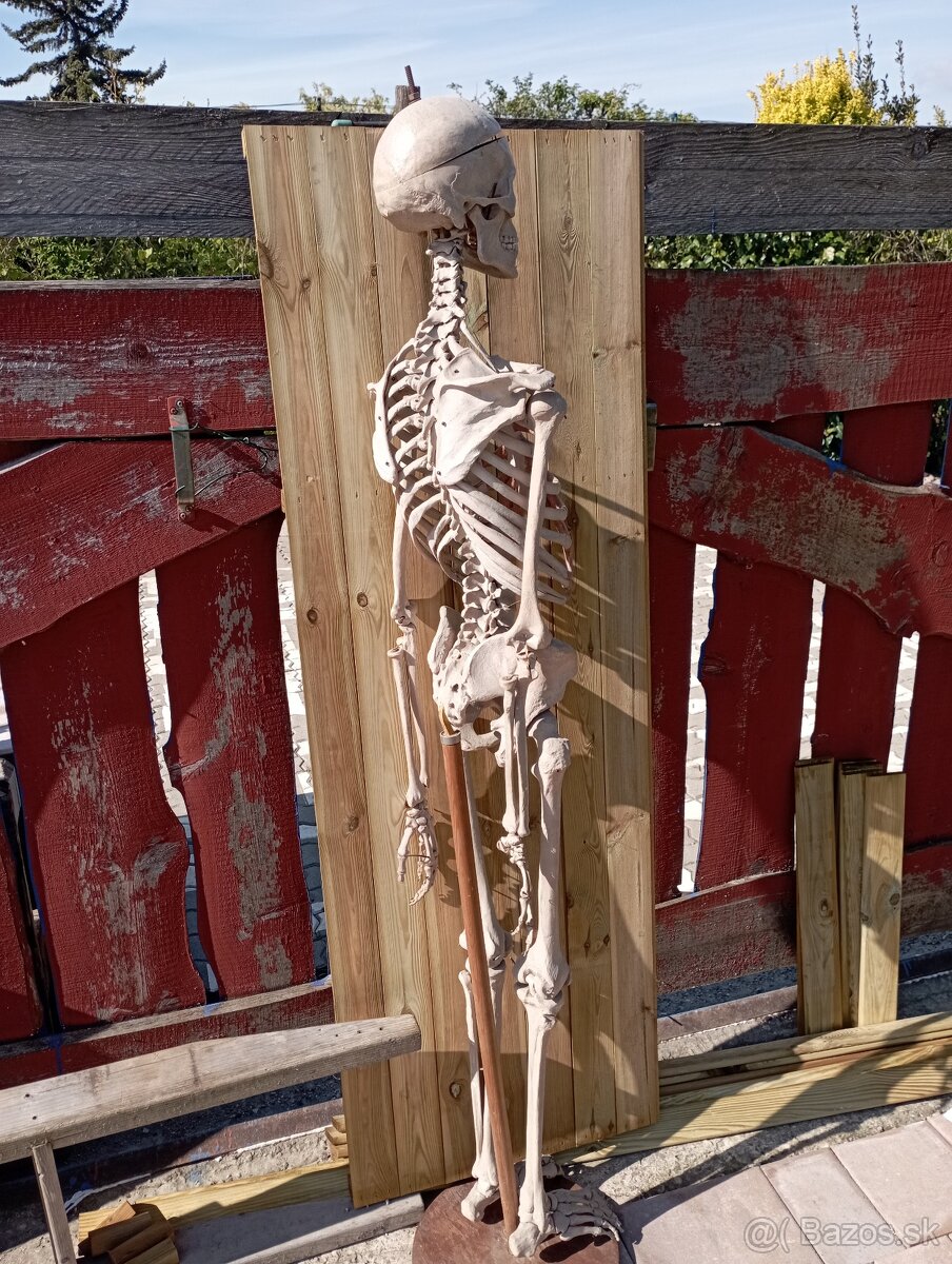 Kostra človeka. Starožitná - 7