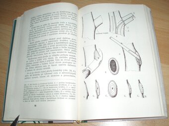 Rez a tvarovanie ovocných drevín - 7