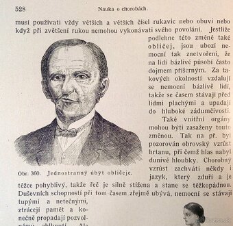 Starožitné lékařské knihy Nové domácí léčení, rok 1920 - 7