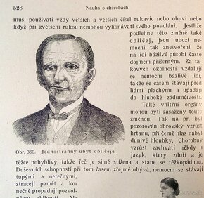 Starožitné lékařské knihy Nové domácí léčení z roku 1920 - 7