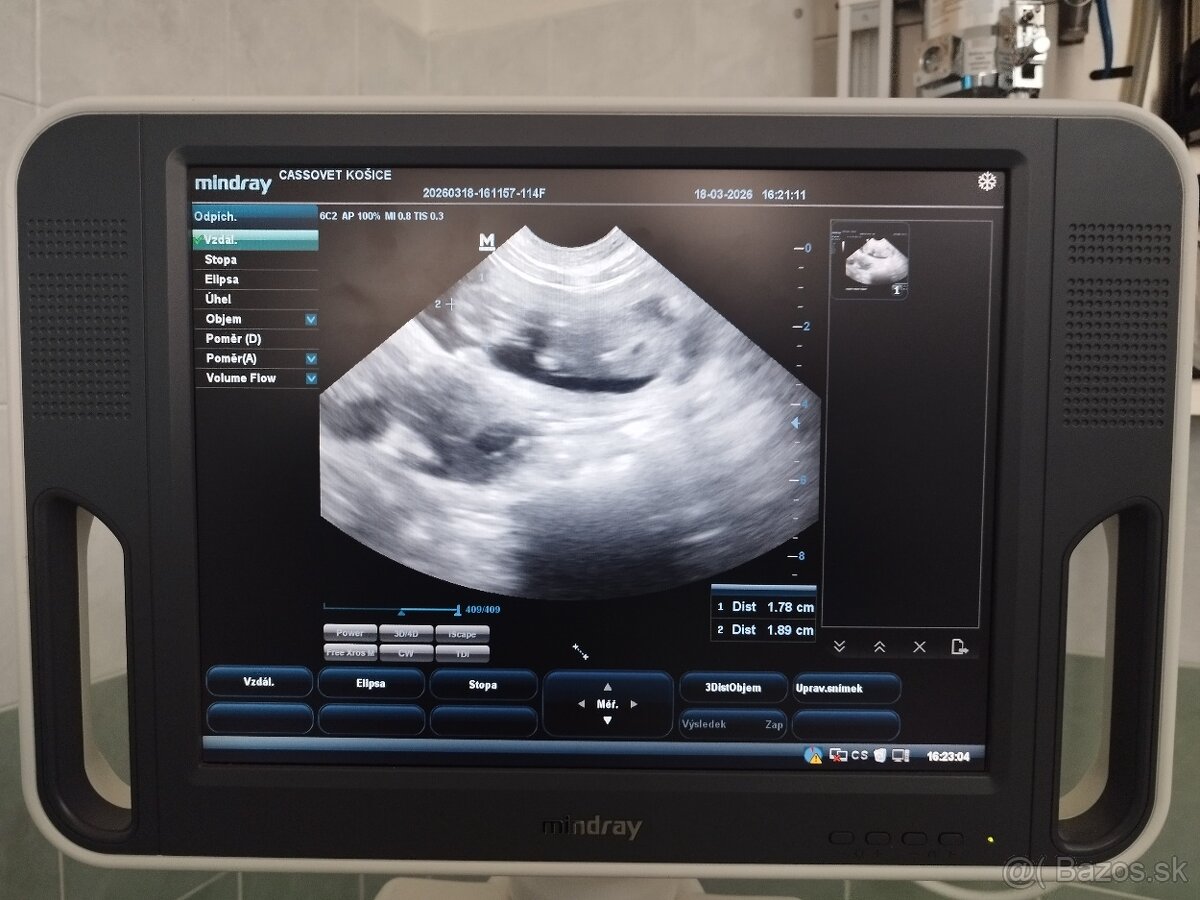 Labradoodle F1bb - 8