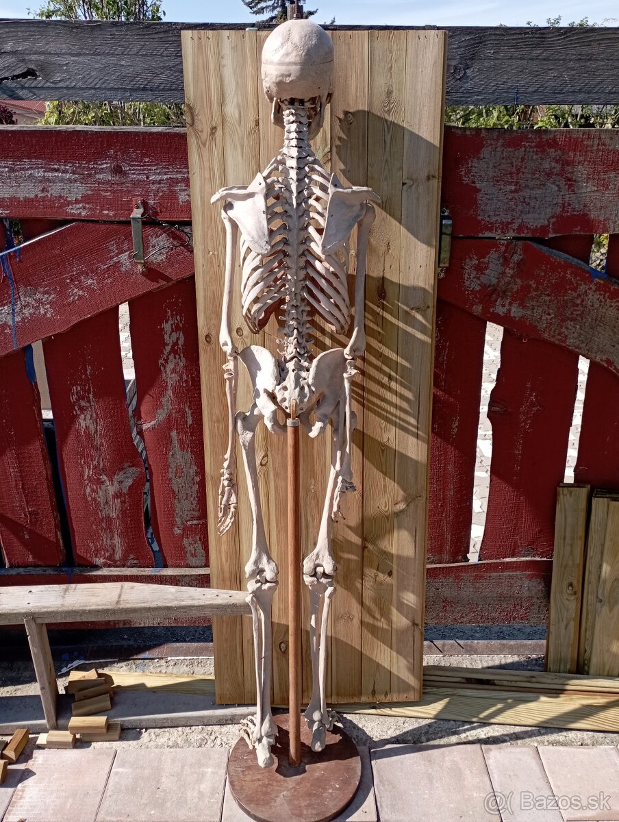 Kostra človeka. Starožitná - 8