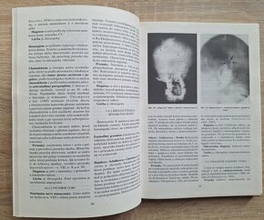 Detska otorinolaryngologia - 8