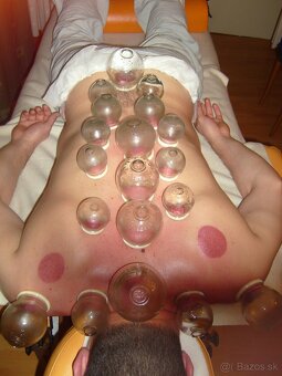 Masáže, wellness a odblokovanie stresov Stropkov - 8
