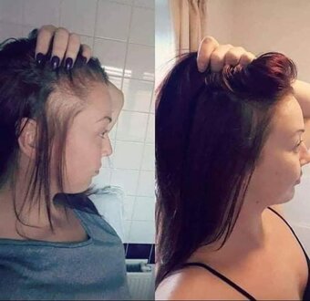 Cesnakový šampón 13e za 2ks - 8