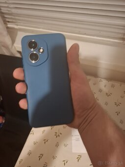 Honor 400 5g - 8