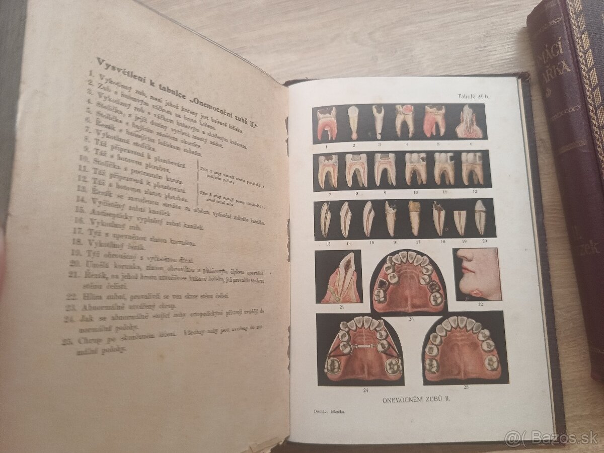 Jenny Springerová: Domáci lekárka I.,II., 1925 + rozkladacie - 9