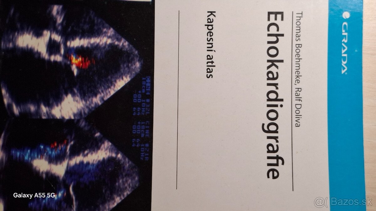 Interná medicína, vnitřní lékařství, Echo - 9