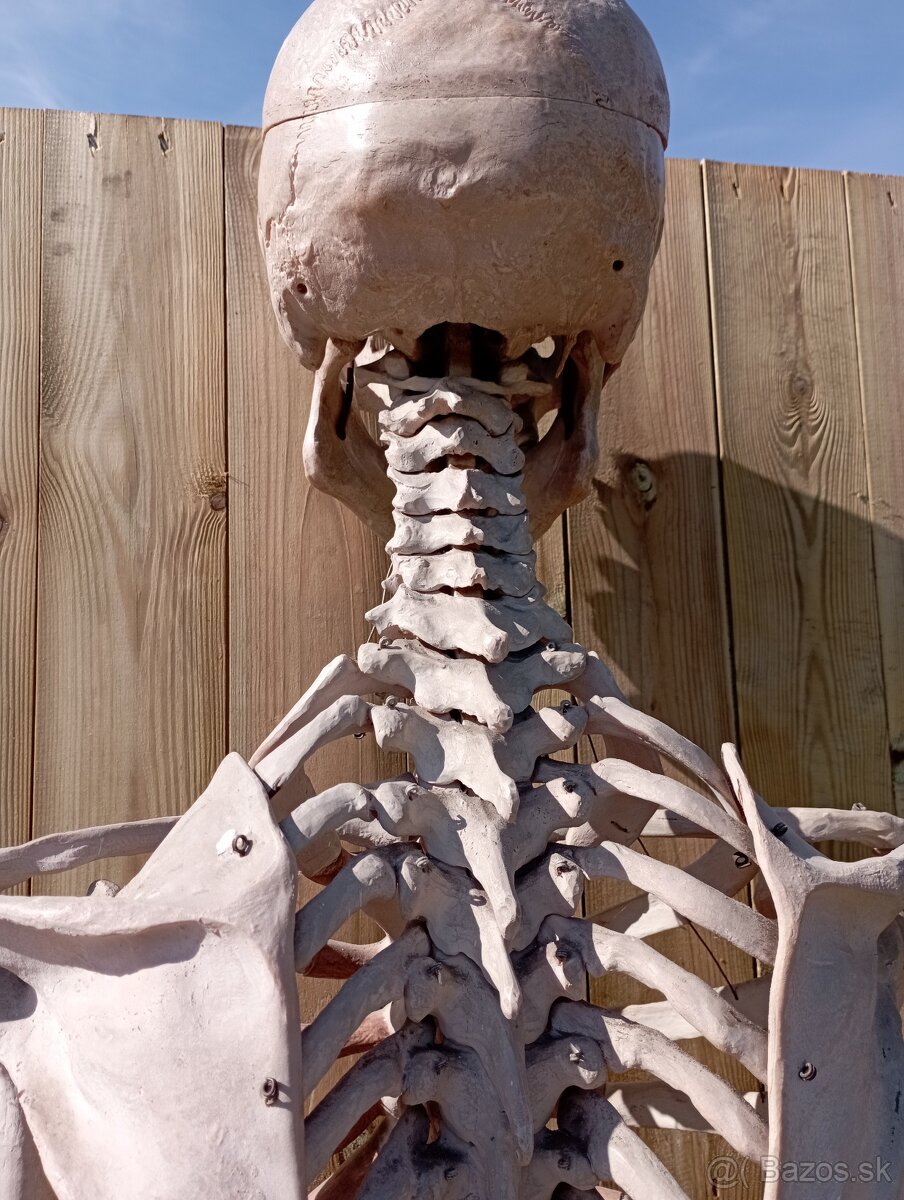 Kostra človeka. Starožitná - 9