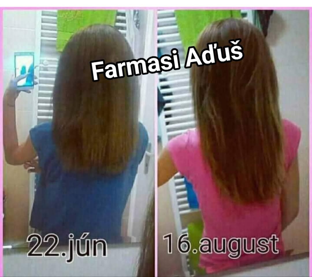 Cesnakový šampón 2kusy 13e - 9