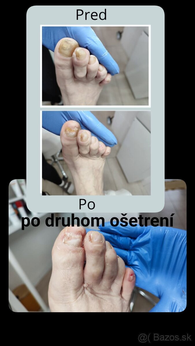 Kozmetika, pedikúra - 9