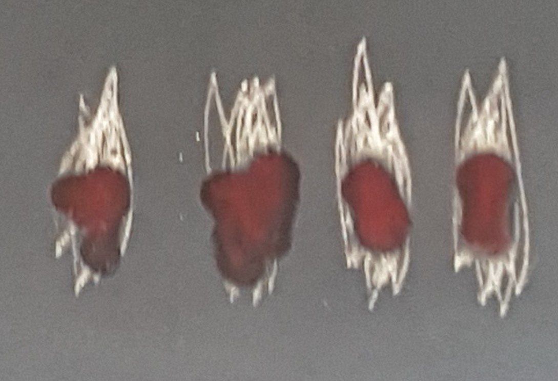 Investičné Striebro–zberateľská sada bohov Ríma-Londýn 1971 - 9