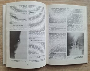 Detska otorinolaryngologia - 9