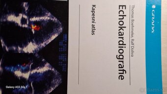 Interná medicína, vnitřní lékařství, Echo - 9