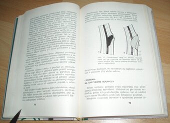 Rez a tvarovanie ovocných drevín - 9