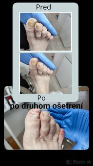 Kozmetika, pedikúra - 9