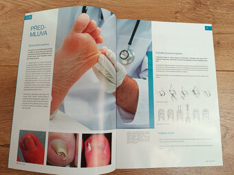 Startovacia sada spon na nechty PODOFIX - 9